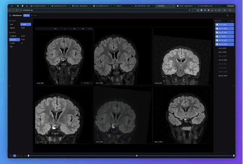 MiraViewer MRI Viewer